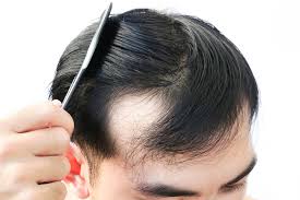 KeraHealth Hair Uomo - controindicazioni - effetti collaterali